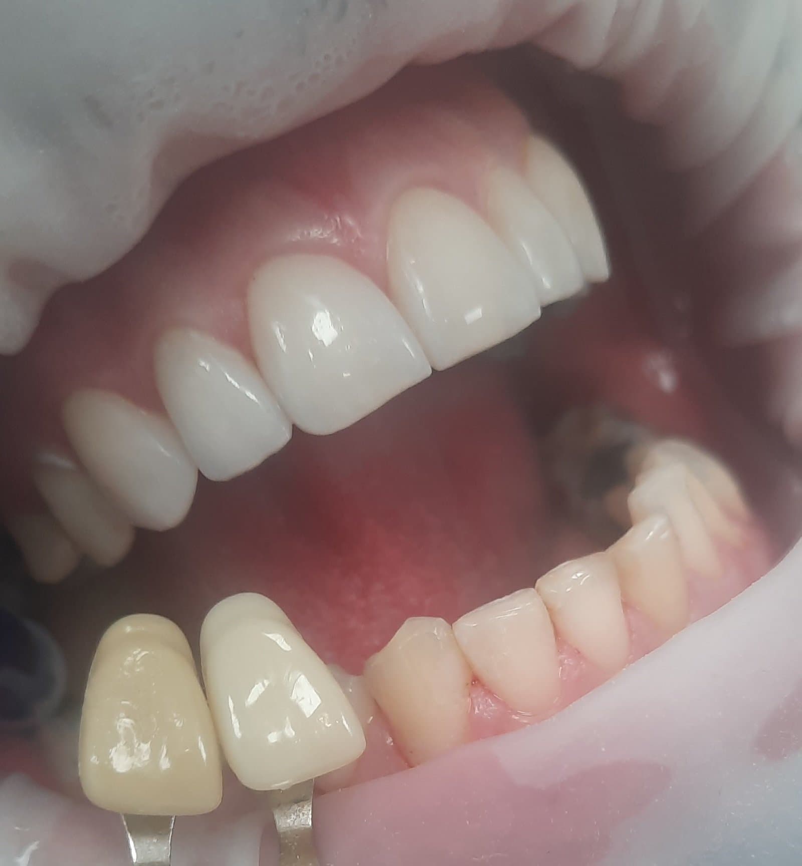 Dentálna hygiena Regina Ibolyová