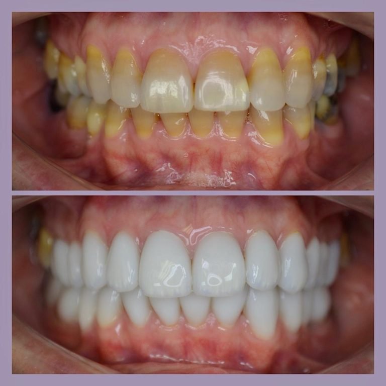 Ružinov Zubná Klinika