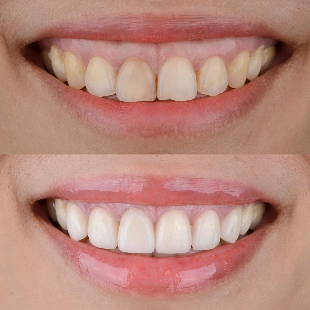 Levi Dental Clinic