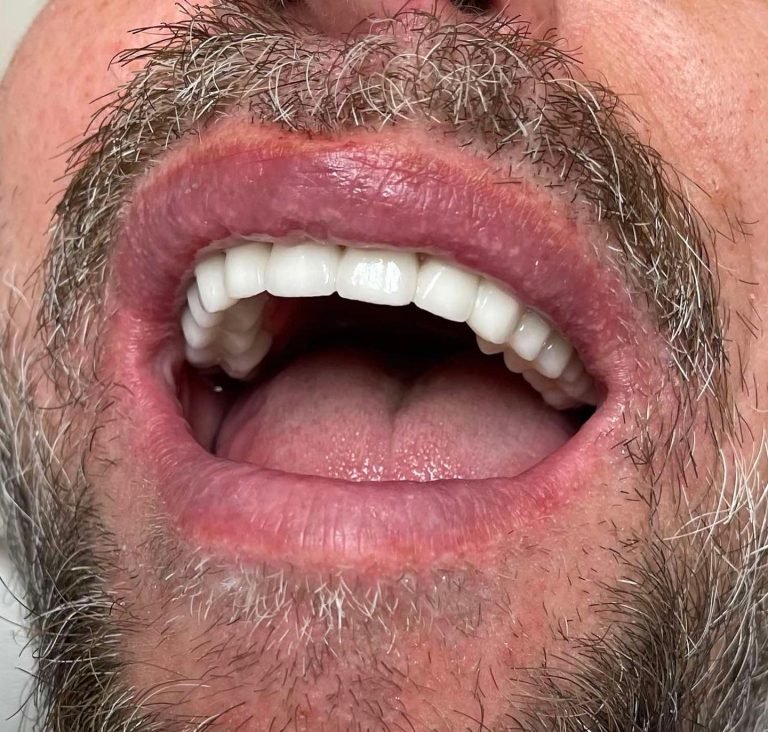 Fort Dental Clinic
