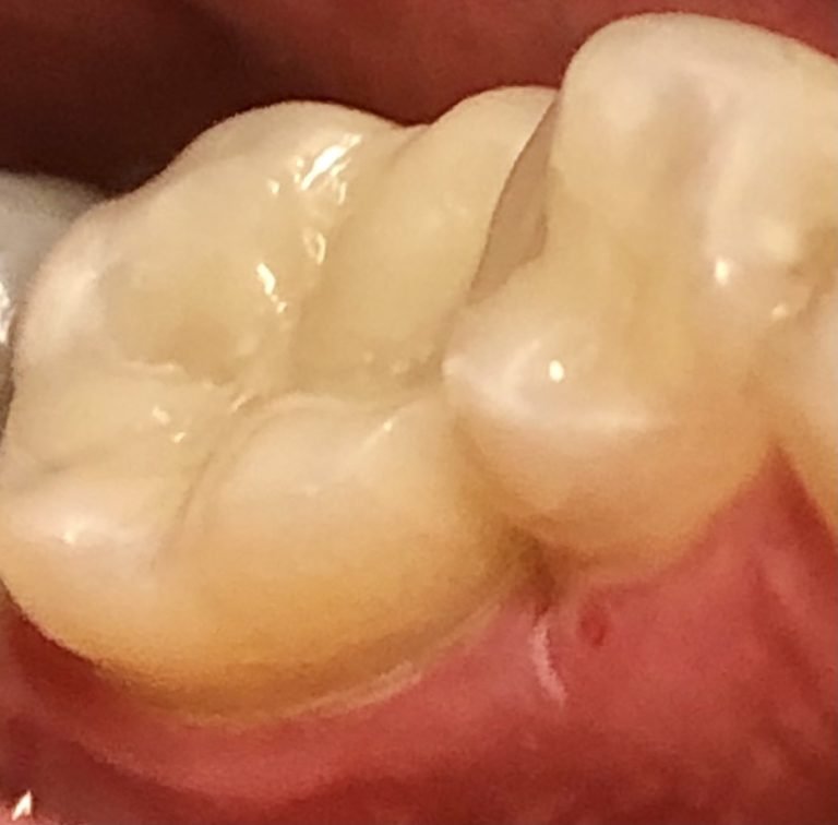 BystricaDent - Zubná ambulancia