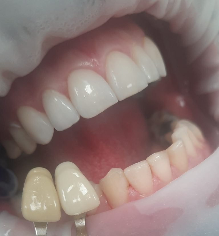 Dentálna hygiena Regina Ibolyová