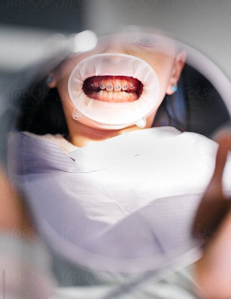 DIAMOND DENTAL - dentálna hygiena Poprad